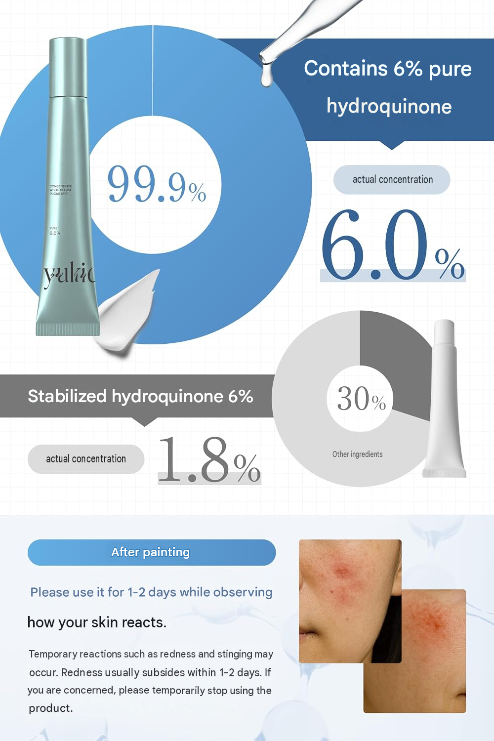 Hokkaido Snowflake Hydroquinone Cream 6% – Brightening & Spot Care, 20g