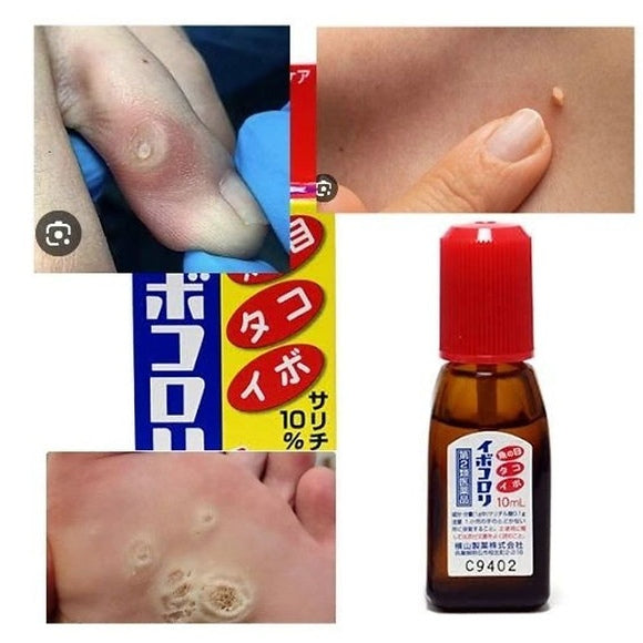 3 set "Hapycom Ibokorori" for removing warts, papillomas, and corns (10ml)