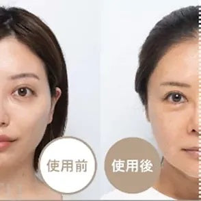 Photo Plus Shiny NEO Cosmetic Device by Ya-man
