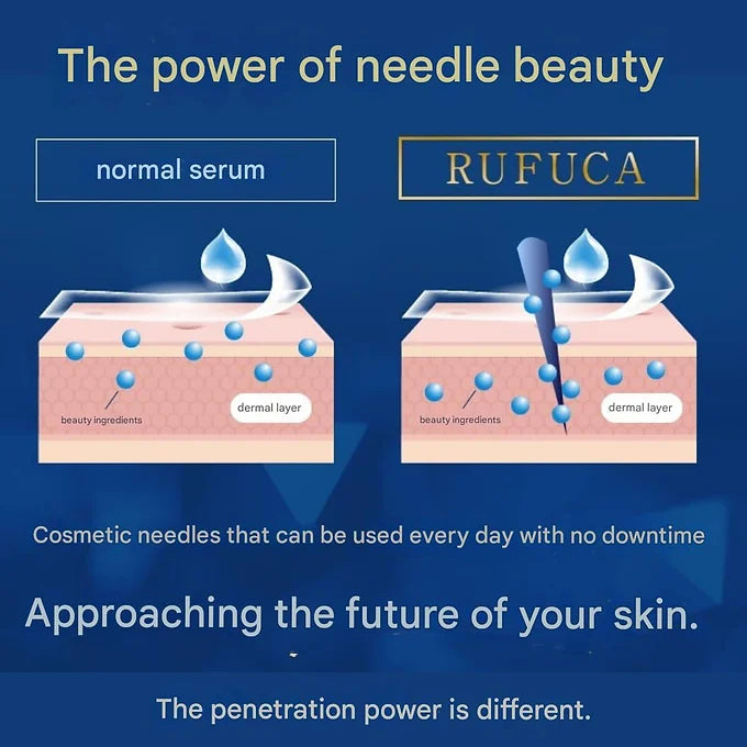 RUFUCA All-in-One Gel with Micro Needles (50g)