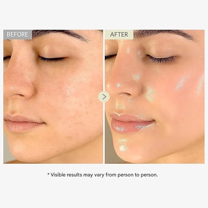 TOSOWOONG Real Collagen Face Serum – 33 ml