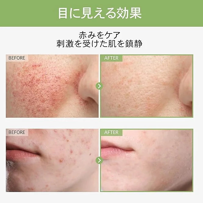 TOSOWOONG Houttuynia (Houtdami) Face Toner (250 ml)