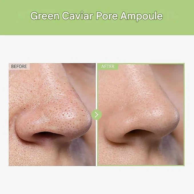 TOSOWOONG Green Caviar Pore Ampoule – 33 ml