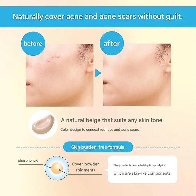 KOSE Acne Care Cover Cream 15g