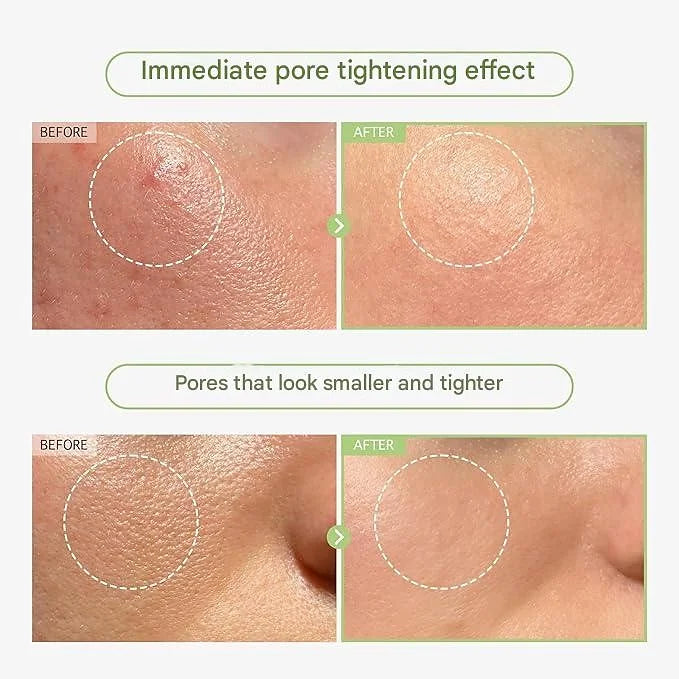 TOSOWOONG Green Caviar Pore Ampoule – 33 ml