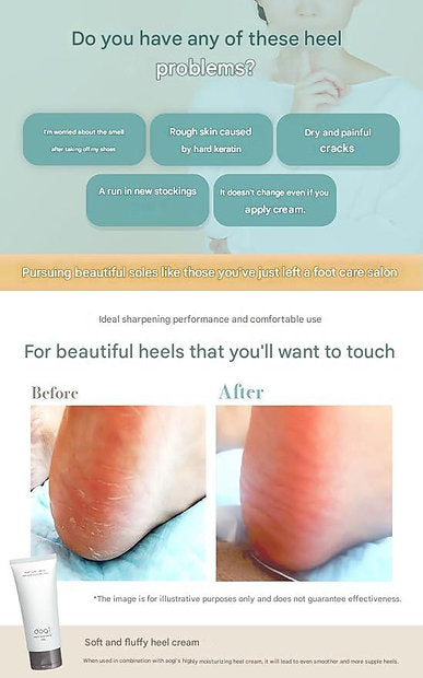Aogi Heel File – Professional Double-Sided Foot Exfoliating Tool (120/220 Grit)
