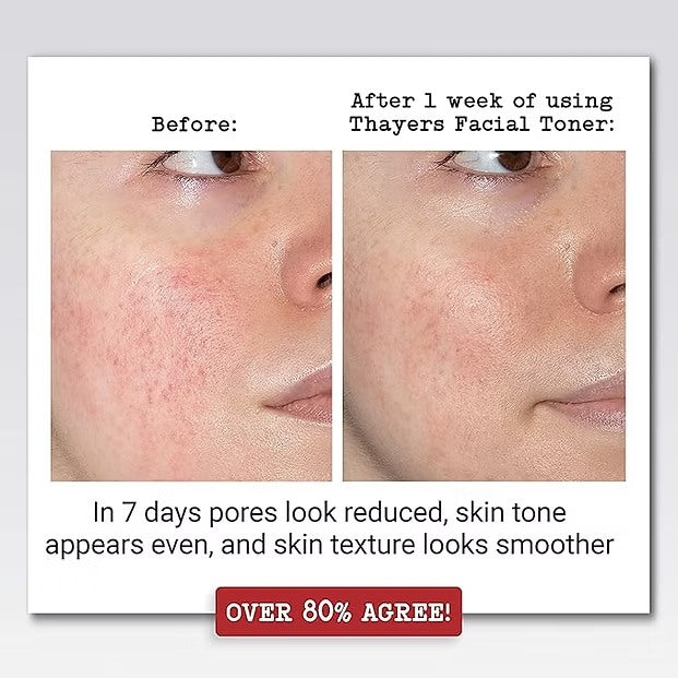 Thayers Facial Toner