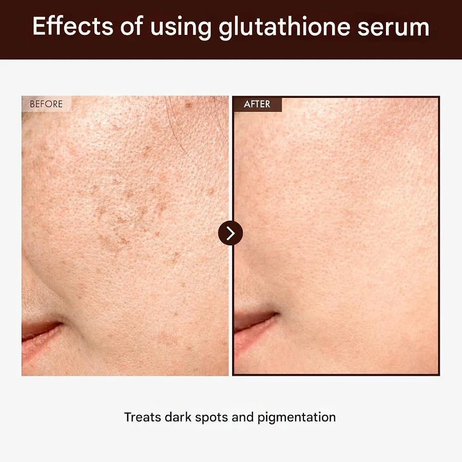 TOSOWOONG Glutathione Serum – 1.0 fl oz (30 ml)