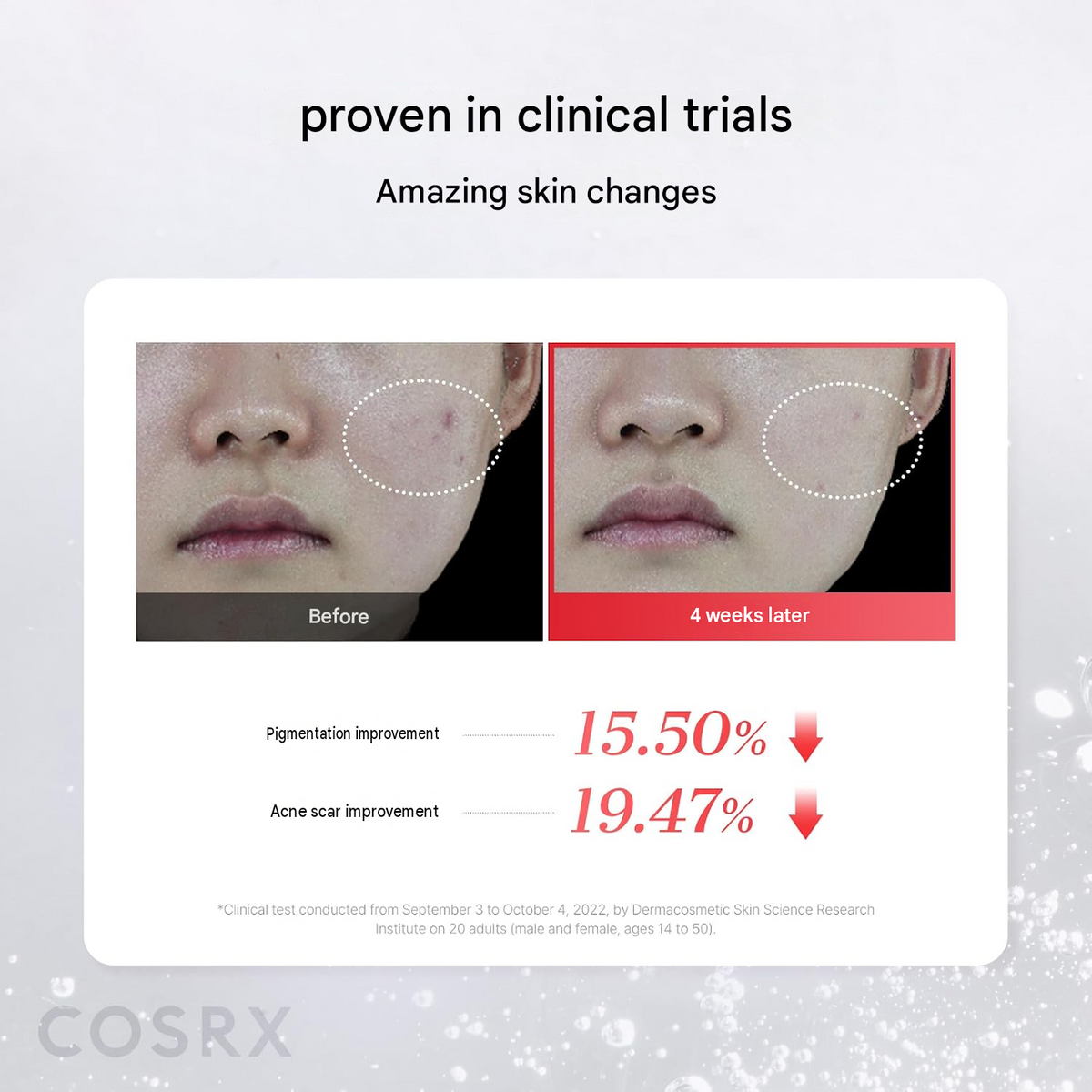 COSRX Niacinamide 15 Serum – 0.7 fl oz (20 ml)