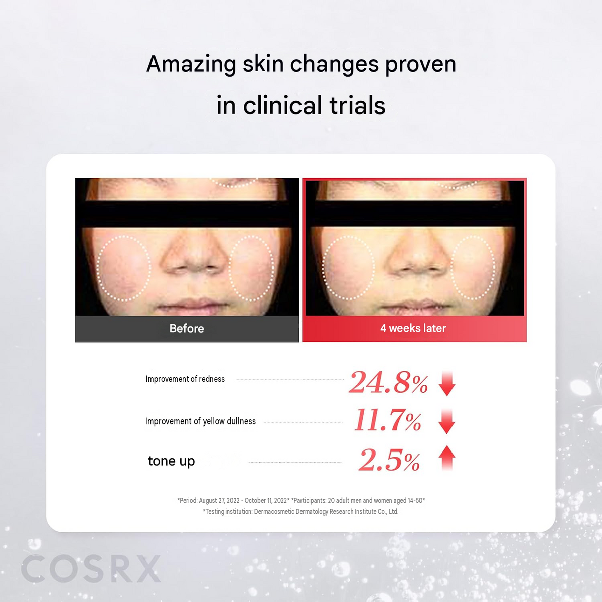 COSRX Niacinamide 15 Serum – 0.7 fl oz (20 ml)